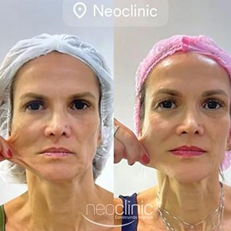 estetica-facial-avancada-em-florianopolis estetica-facial-avancada-em-florianopolis