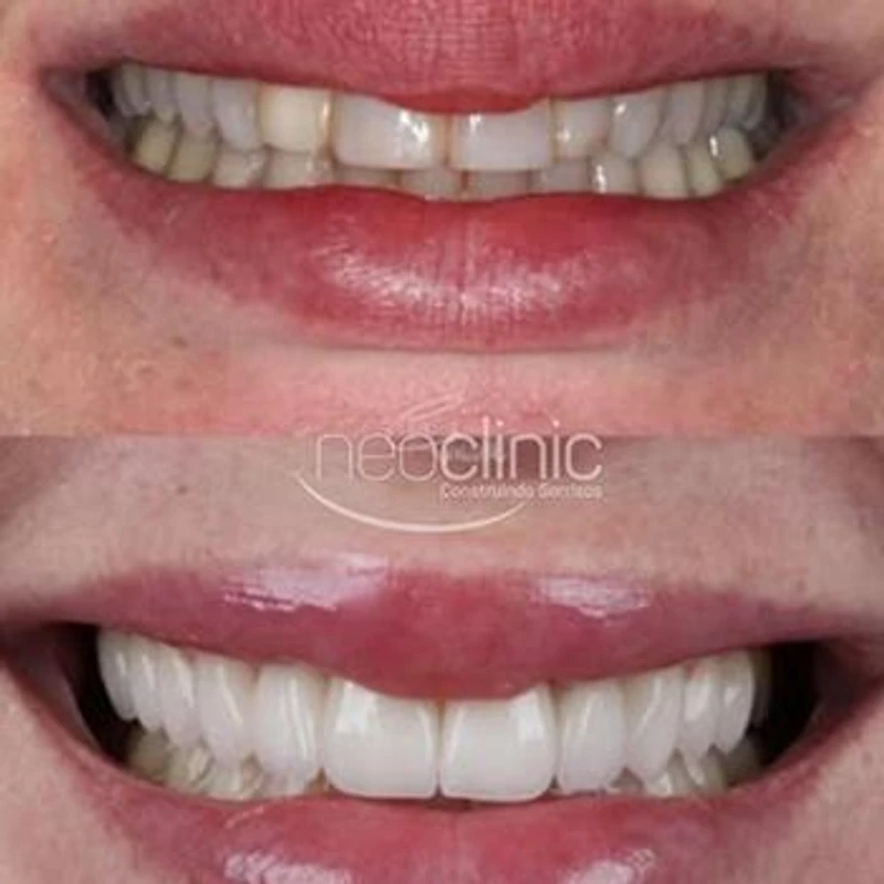 odontologia-estetica-em-florianopolis odontologia-estetica-em-florianopolis