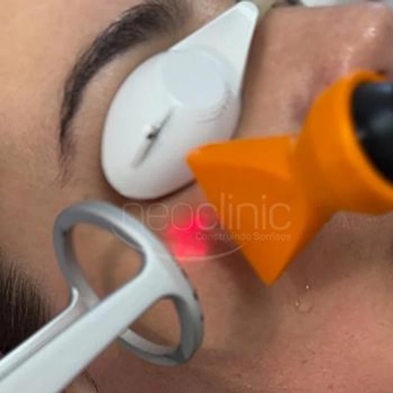 laser-lavieen-o-que-e-e-como-funciona laser-lavieen-o-que-e-e-como-funciona