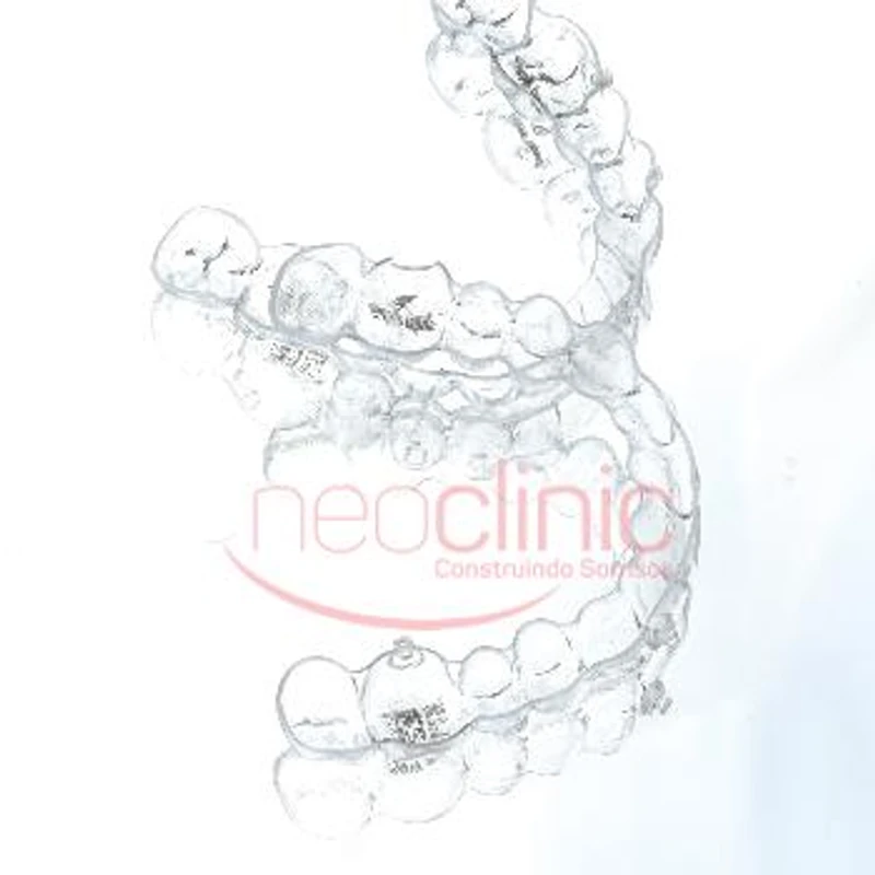 invisalign invisalign
