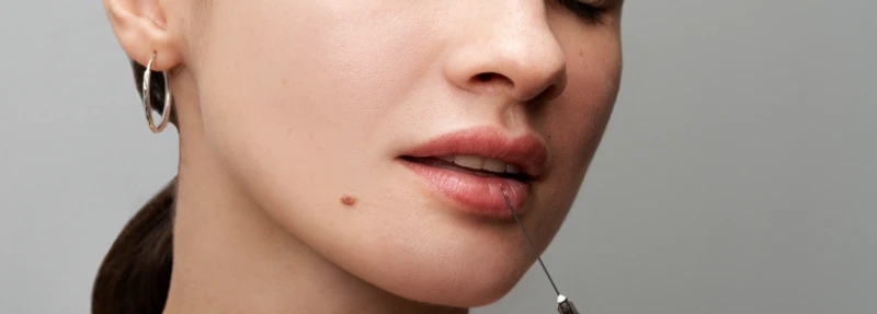 Quanto tempo dura o preenchimento labial?