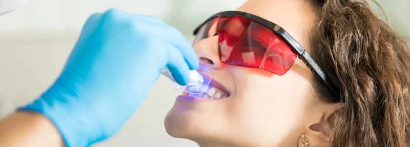 Riscos do clareamento dental caseiro sem orientação